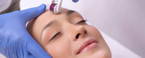 microneedling