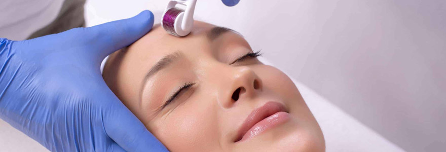 microneedling